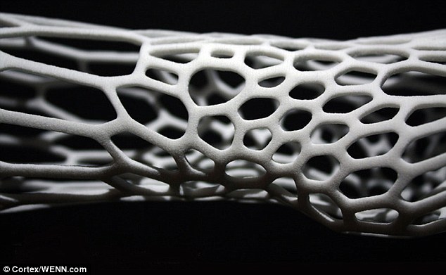 3D-печатный экзоскелет для сломанных костей