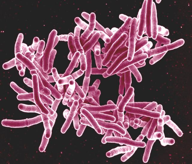 Туберкулез определят по дыханию