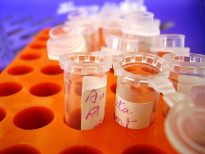 Способ лечения рака найден учеными