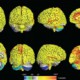 Мозг женщин оказался активнее по сравнению с мужчинами