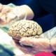 Способен ли большой мозг делать человека умнее?